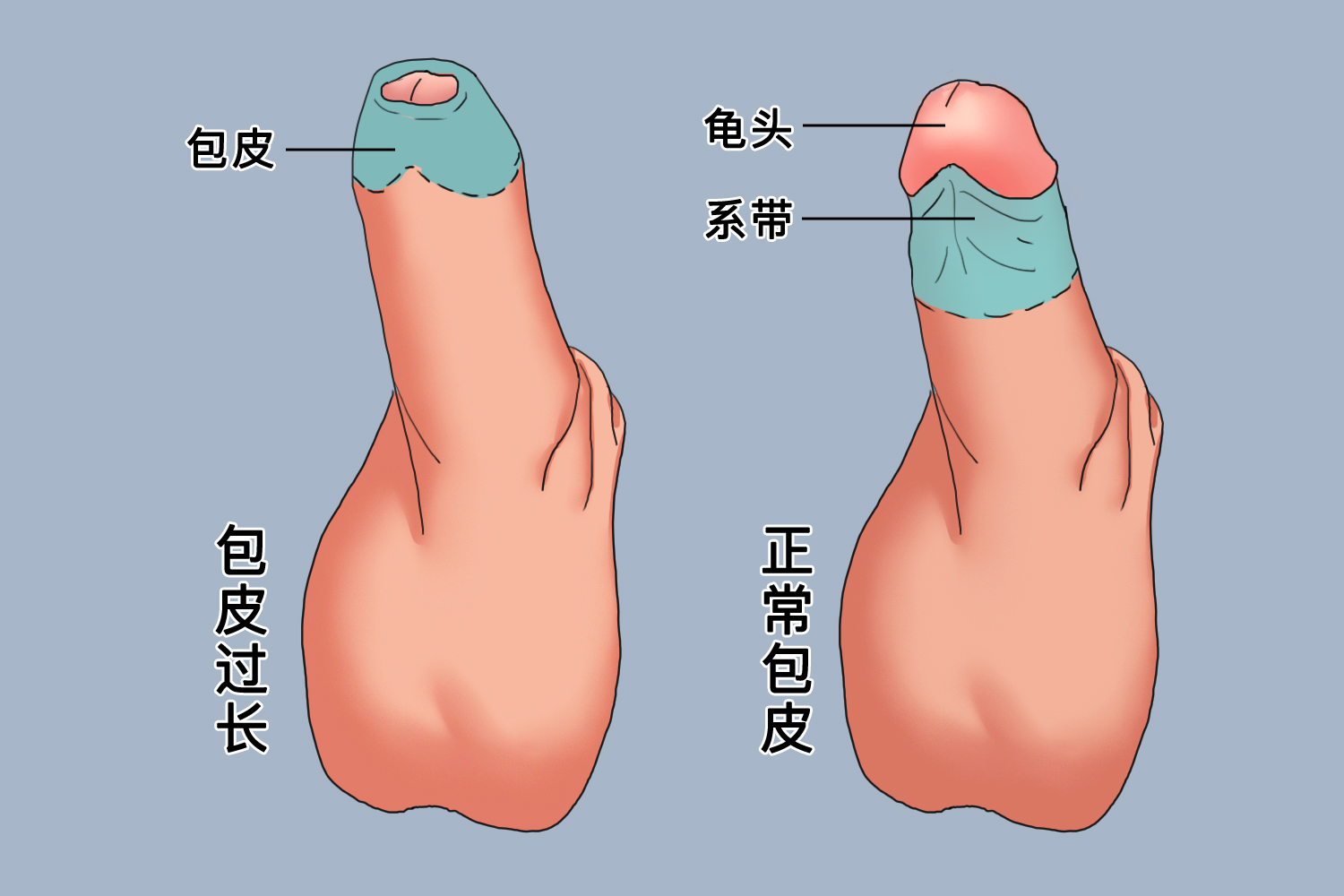 正常包皮的圖片及其相關(guān)知識科普，包皮圖片及其相關(guān)知識科普介紹