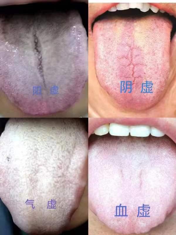 男性腎陽(yáng)虛的癥狀及其影響，男性腎陽(yáng)虛癥狀與影響概述